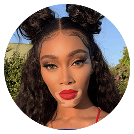 Winnie Harlow